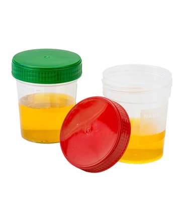 Specimen Container