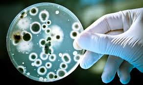 Petri dish with bacteria. 